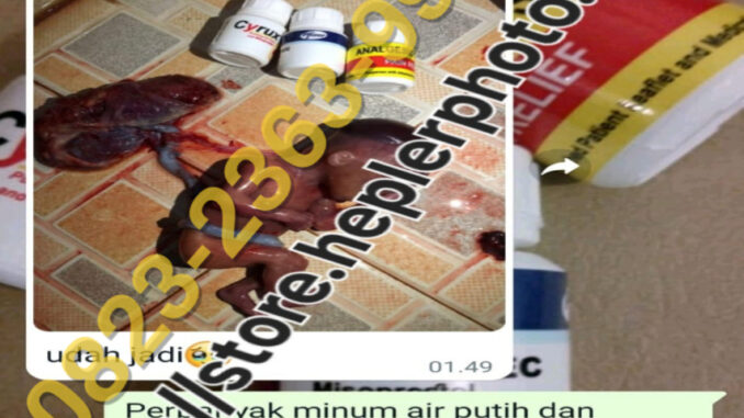 cara menggugurkan kandungan usia kehamilan 1-8 bulan
